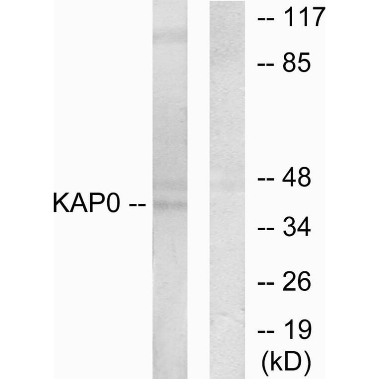 Western Blot - Anti-KAP0 Antibody (C10337) - Antibodies.com