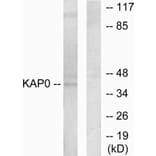 Western Blot - Anti-KAP0 Antibody (C10337) - Antibodies.com