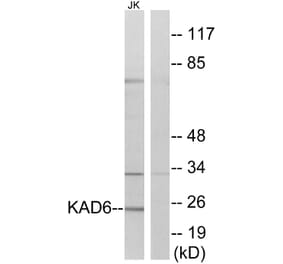 Western Blot - Anti-KAD6 Antibody (C11948) - Antibodies.com
