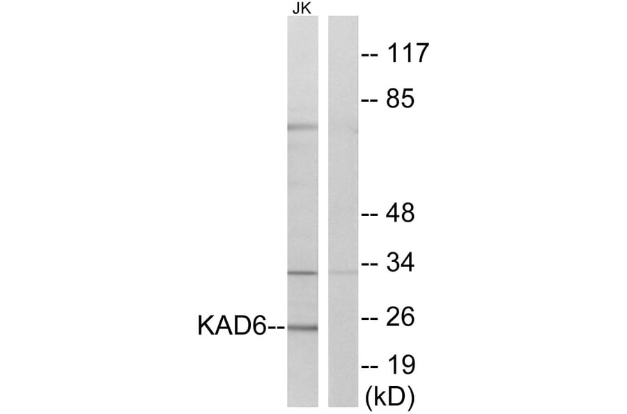 Western Blot - Anti-KAD6 Antibody (C11948) - Antibodies.com