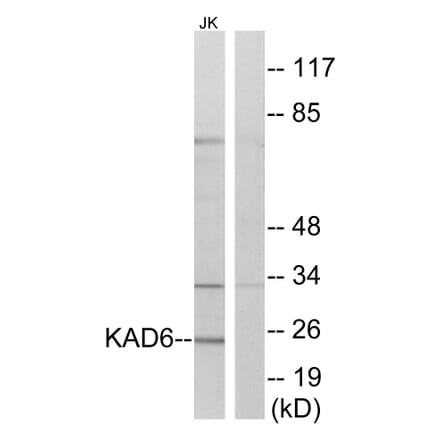 Western Blot - Anti-KAD6 Antibody (C11948) - Antibodies.com