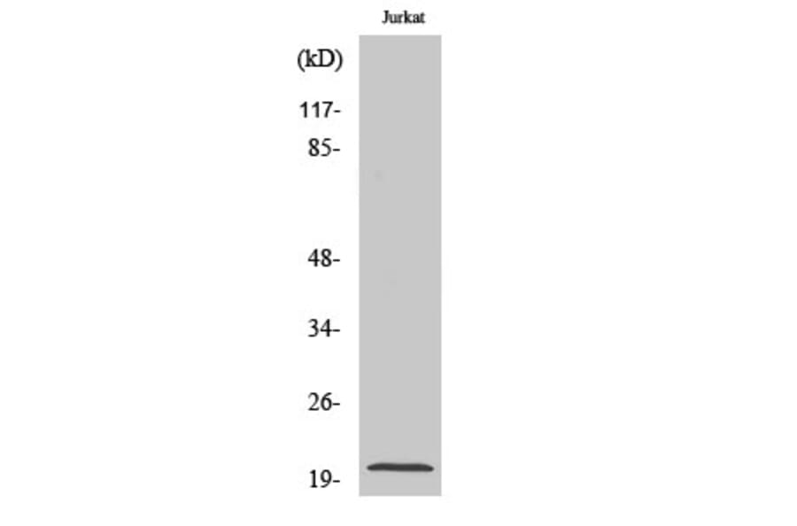 Western Blot - Anti-KAD6 Antibody (C11948) - Antibodies.com