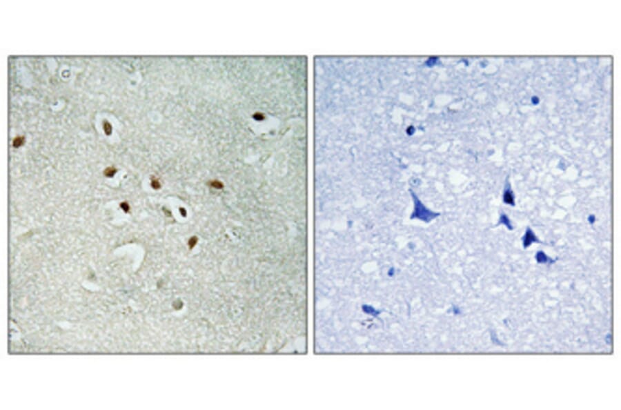 Immunohistochemistry - Anti-KAD6 Antibody (C11948) - Antibodies.com