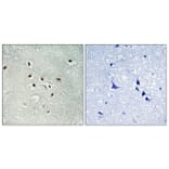 Immunohistochemistry - Anti-KAD6 Antibody (C11948) - Antibodies.com