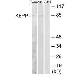 Western Blot - Anti-K6PP Antibody (C10836) - Antibodies.com