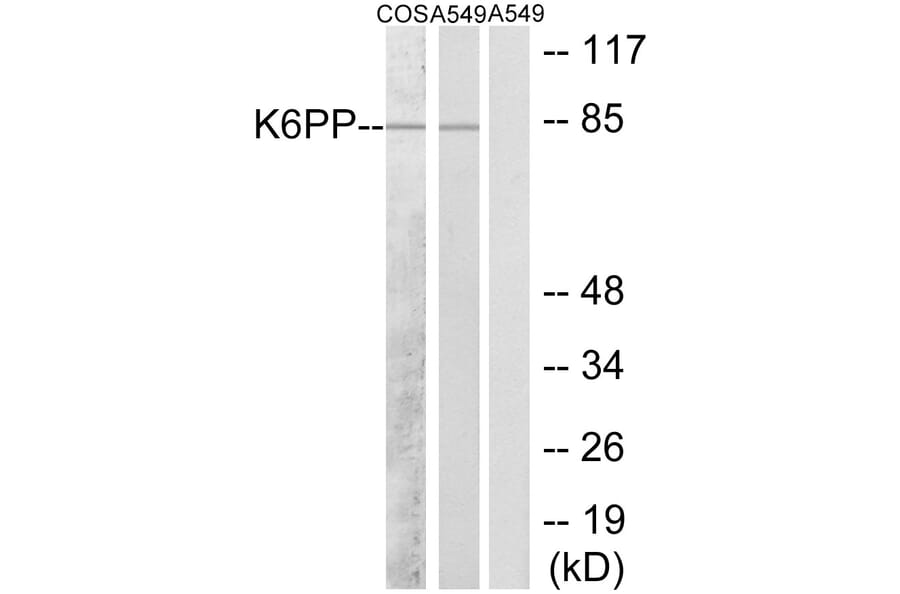 Western Blot - Anti-K6PP Antibody (C10836) - Antibodies.com