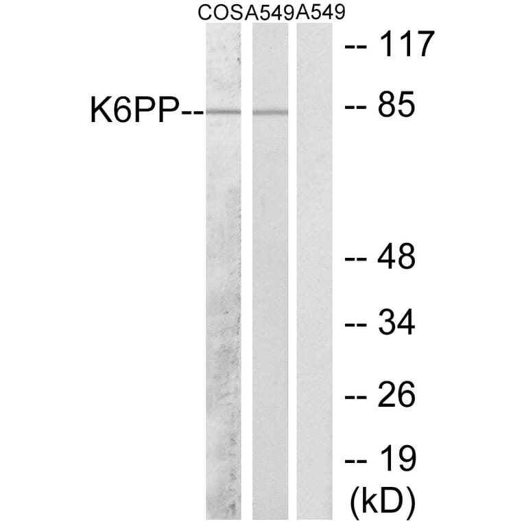 Western Blot - Anti-K6PP Antibody (C10836) - Antibodies.com