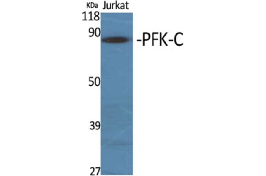 Western Blot - Anti-K6PP Antibody (C10836) - Antibodies.com