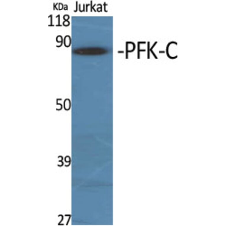 Western Blot - Anti-K6PP Antibody (C10836) - Antibodies.com