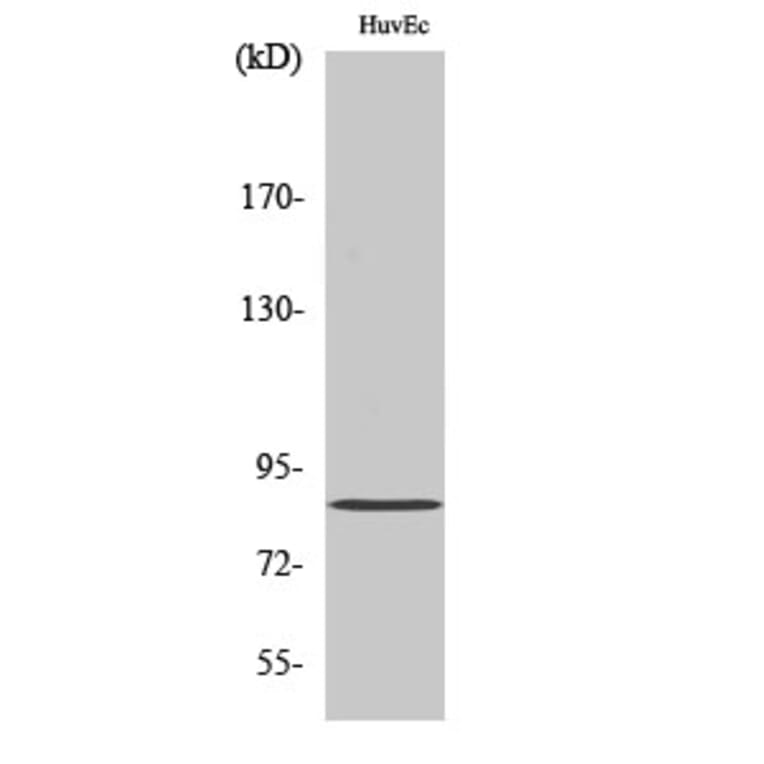 Western Blot - Anti-K6PP Antibody (C10836) - Antibodies.com