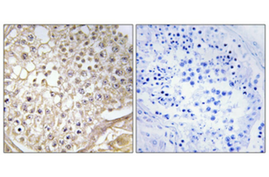 Immunohistochemistry - Anti-K6PP Antibody (C10836) - Antibodies.com