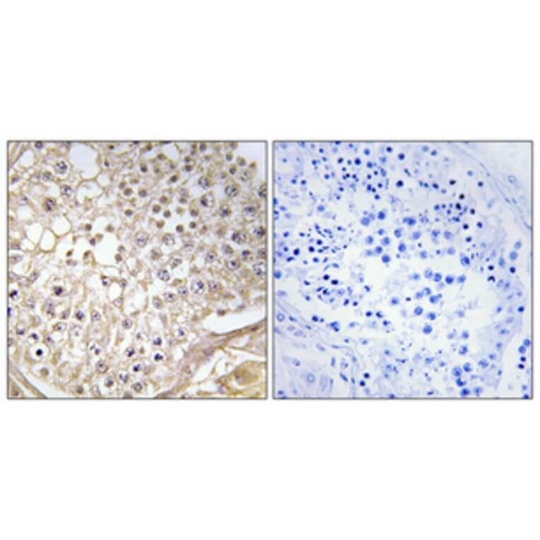 Immunohistochemistry - Anti-K6PP Antibody (C10836) - Antibodies.com