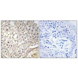 Immunohistochemistry - Anti-K6PP Antibody (C10836) - Antibodies.com