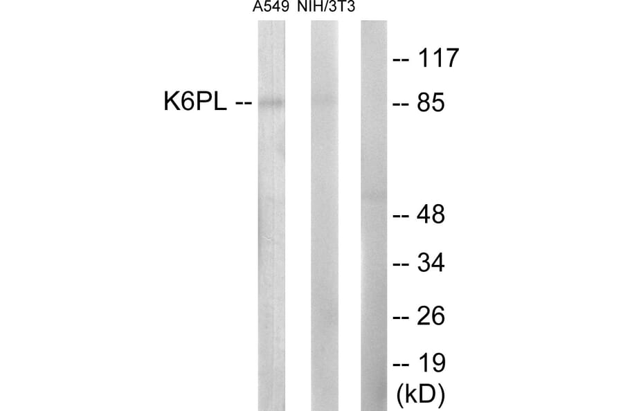Western Blot - Anti-K6PL Antibody (C10412) - Antibodies.com