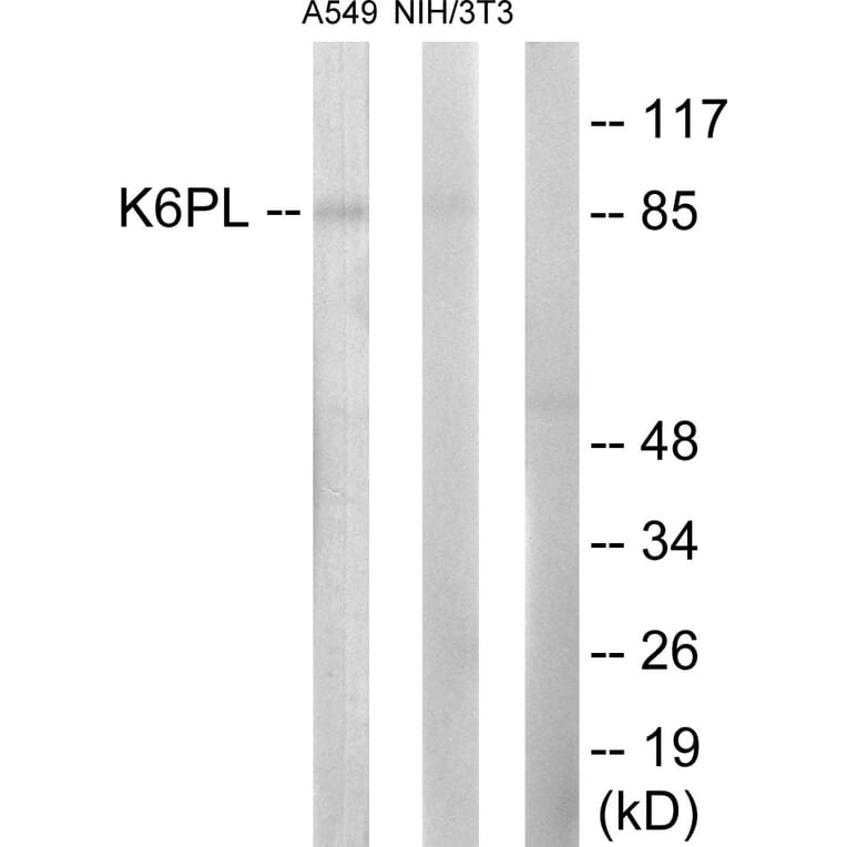 Western Blot - Anti-K6PL Antibody (C10412) - Antibodies.com