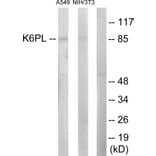 Western Blot - Anti-K6PL Antibody (C10412) - Antibodies.com