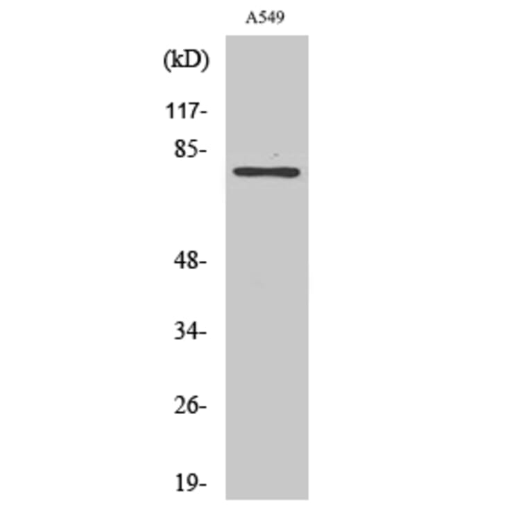 Western Blot - Anti-K6PL Antibody (C10412) - Antibodies.com