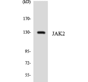 Western Blot - Anti-JAK2 Antibody (R12-2940) - Antibodies.com