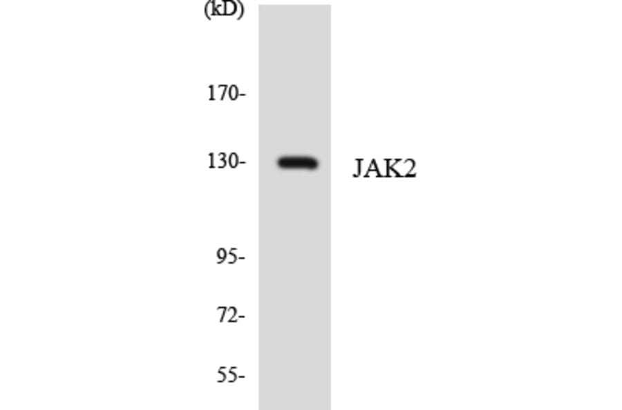 Western Blot - Anti-JAK2 Antibody (R12-2940) - Antibodies.com