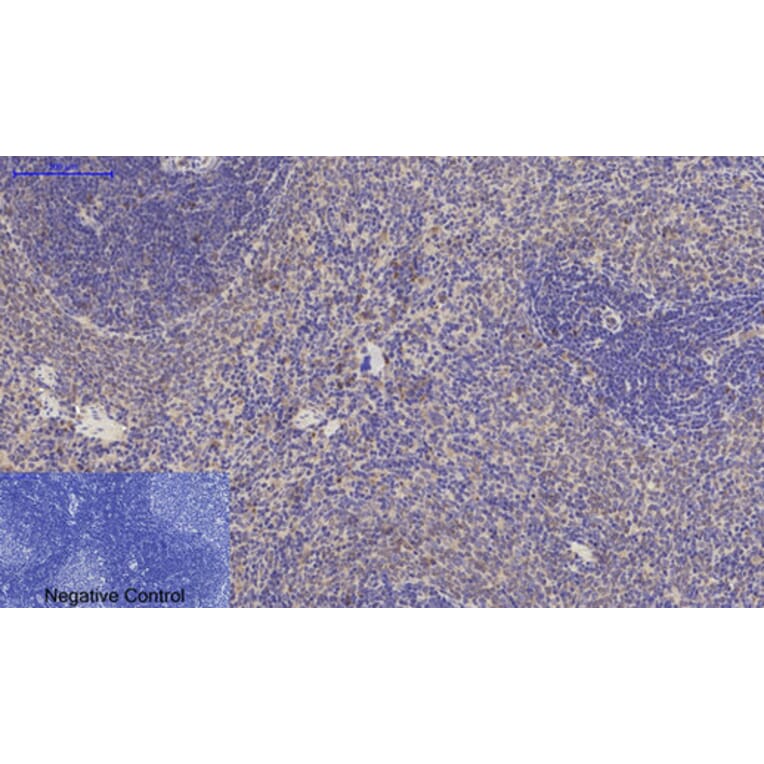 Immunohistochemistry - Anti-JAG1 Antibody (C30483) - Antibodies.com
