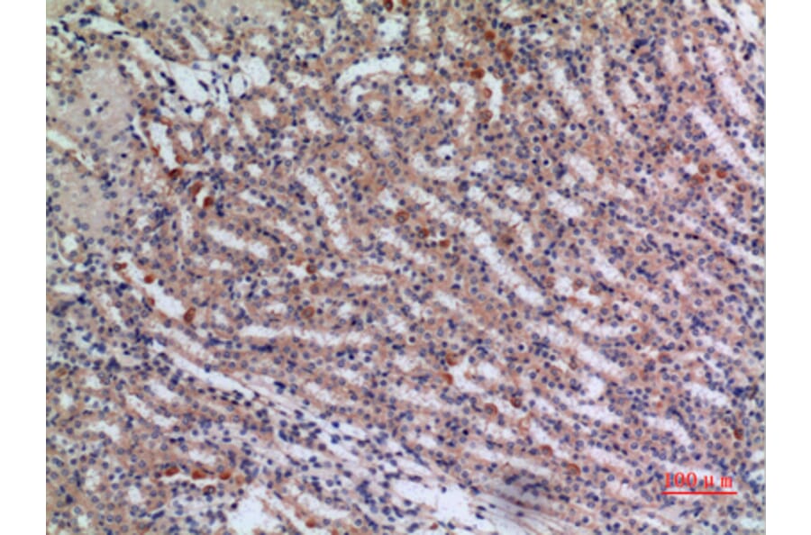 Immunohistochemistry - Anti-JAG1 Antibody (C30483) - Antibodies.com