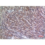 Immunohistochemistry - Anti-JAG1 Antibody (C30483) - Antibodies.com