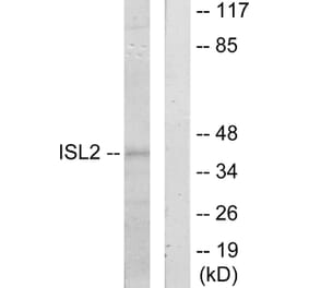 Western Blot - Anti-ISL2 Antibody (C11470) - Antibodies.com