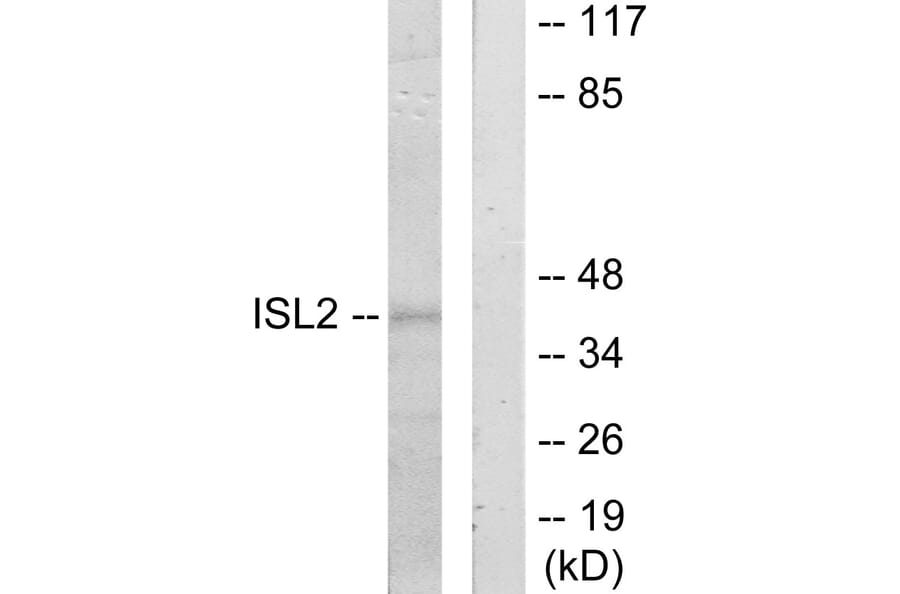 Western Blot - Anti-ISL2 Antibody (C11470) - Antibodies.com