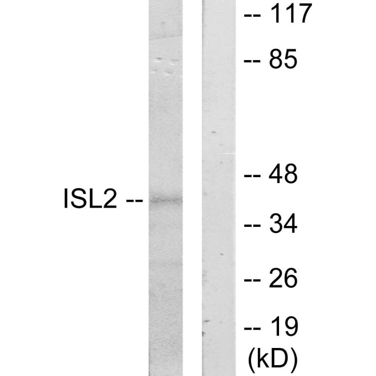 Western Blot - Anti-ISL2 Antibody (C11470) - Antibodies.com