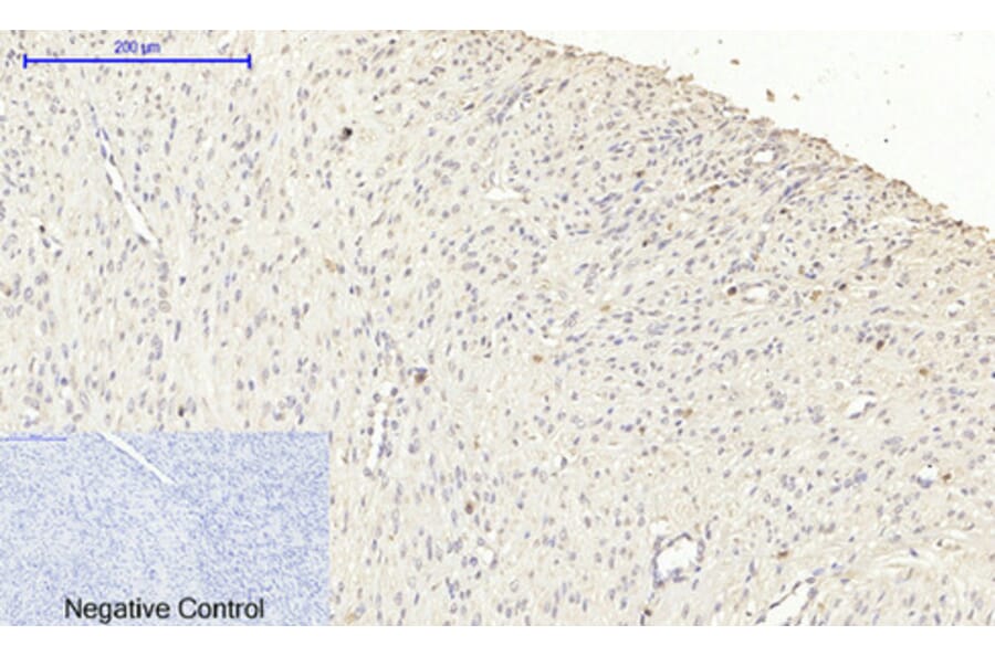 Immunohistochemistry - Anti-iNOS Antibody (B8233) - Antibodies.com