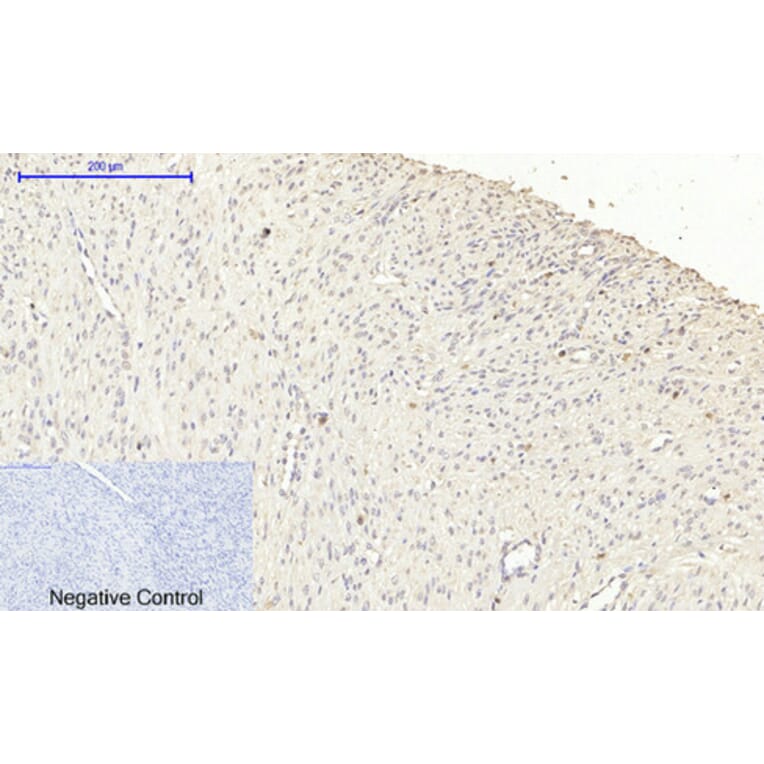 Immunohistochemistry - Anti-iNOS Antibody (B8233) - Antibodies.com