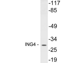 Western Blot - Anti-ING4 Antibody (R12-2215) - Antibodies.com