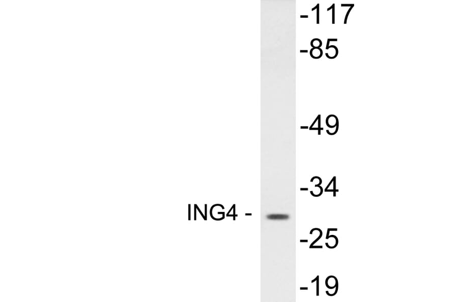 Western Blot - Anti-ING4 Antibody (R12-2215) - Antibodies.com
