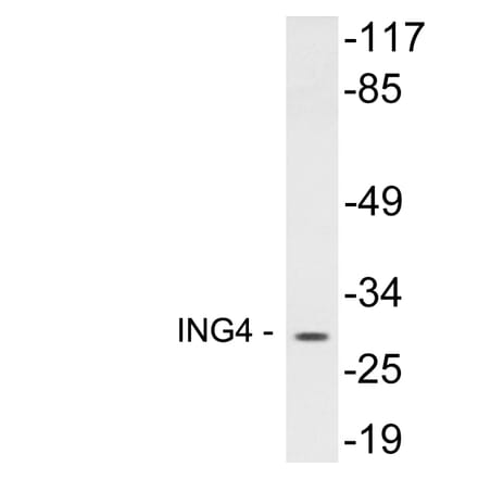 Western Blot - Anti-ING4 Antibody (R12-2215) - Antibodies.com