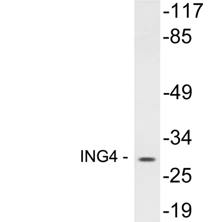 Western Blot - Anti-ING4 Antibody (R12-2215) - Antibodies.com
