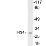 Western Blot - Anti-ING4 Antibody (R12-2215) - Antibodies.com