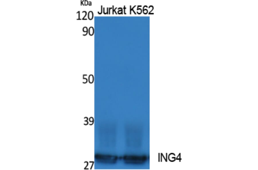 Western Blot - Anti-ING4 Antibody (R12-2215) - Antibodies.com
