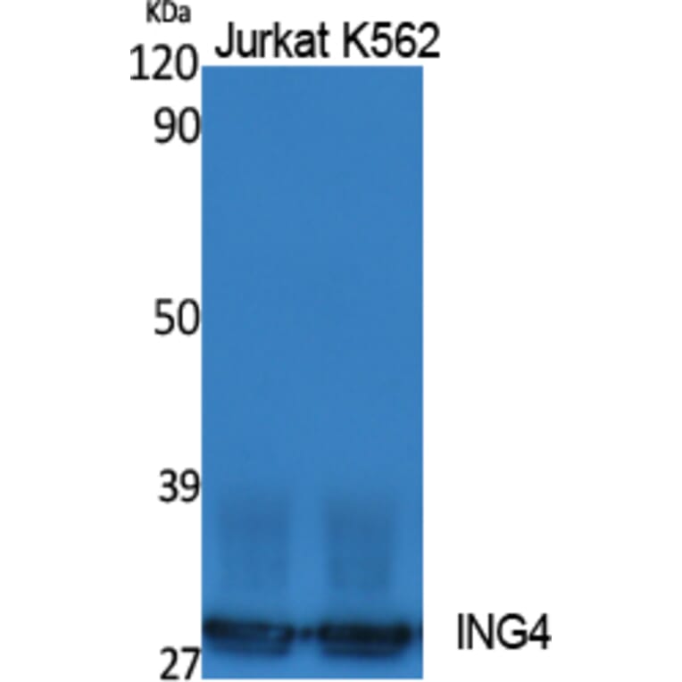 Western Blot - Anti-ING4 Antibody (R12-2215) - Antibodies.com
