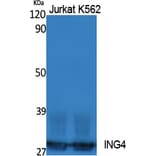 Western Blot - Anti-ING4 Antibody (R12-2215) - Antibodies.com