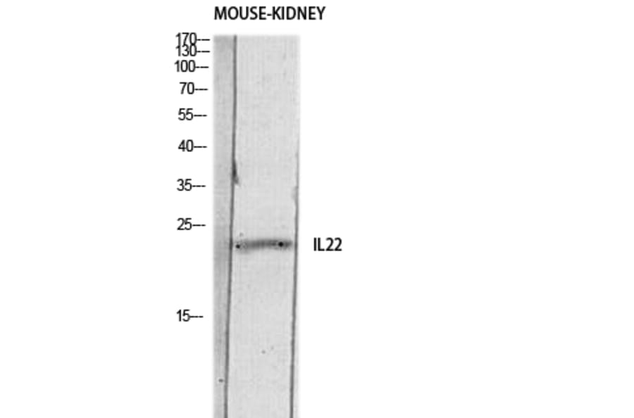 Western Blot - Anti-IL22 Antibody (C30635) - Antibodies.com