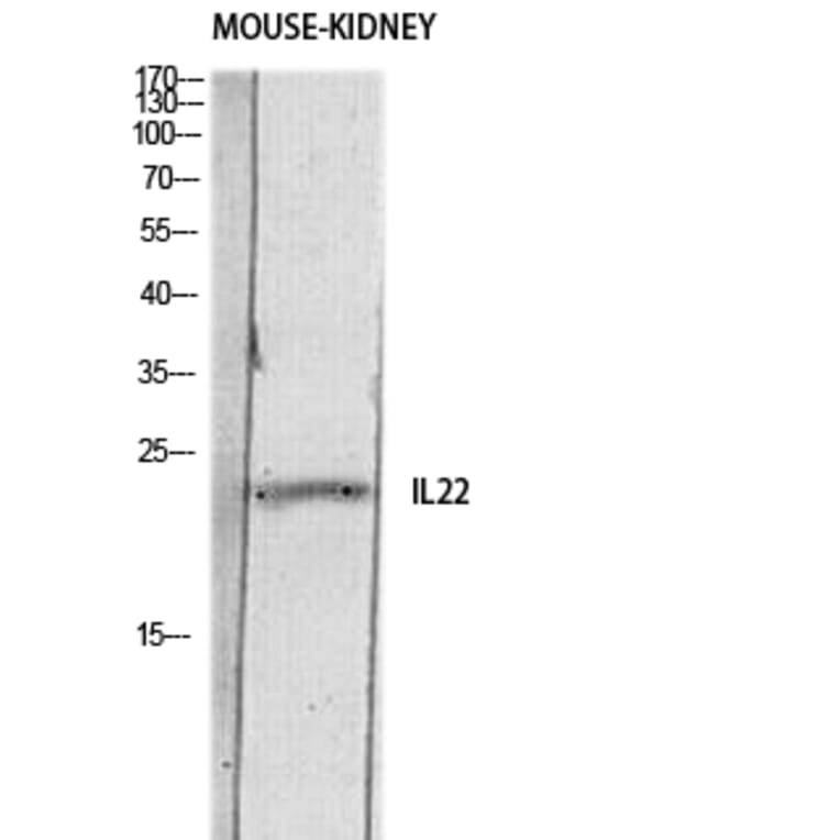 Western Blot - Anti-IL22 Antibody (C30635) - Antibodies.com