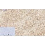 Immunohistochemistry - Anti-IL1B Antibody (C30147) - Antibodies.com