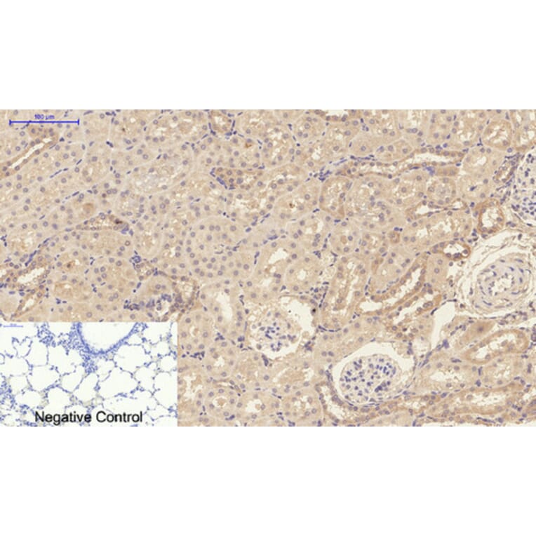 Immunohistochemistry - Anti-IL1B Antibody (C30147) - Antibodies.com