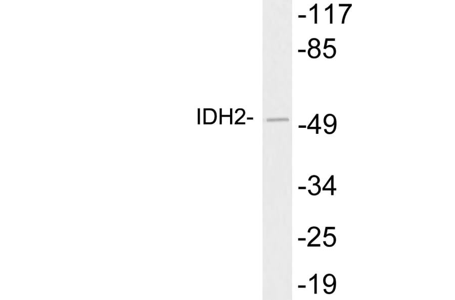 Western Blot - Anti-IDH2 Antibody (R12-2190) - Antibodies.com