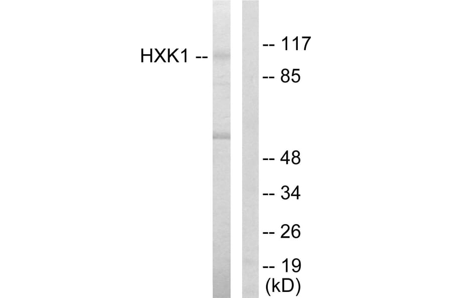 Western Blot - Anti-HXK1 Antibody (C10424) - Antibodies.com