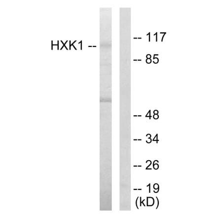 Western Blot - Anti-HXK1 Antibody (C10424) - Antibodies.com