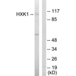 Western Blot - Anti-HXK1 Antibody (C10424) - Antibodies.com