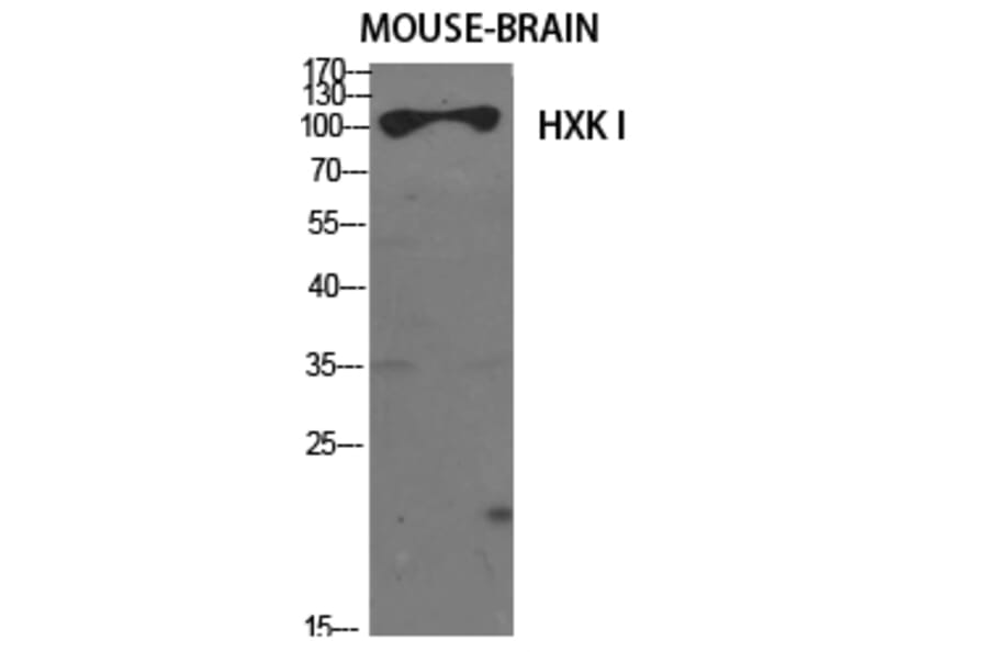 Western Blot - Anti-HXK1 Antibody (C10424) - Antibodies.com
