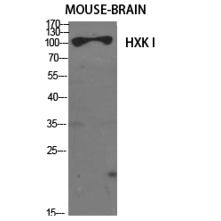 Western Blot - Anti-HXK1 Antibody (C10424) - Antibodies.com