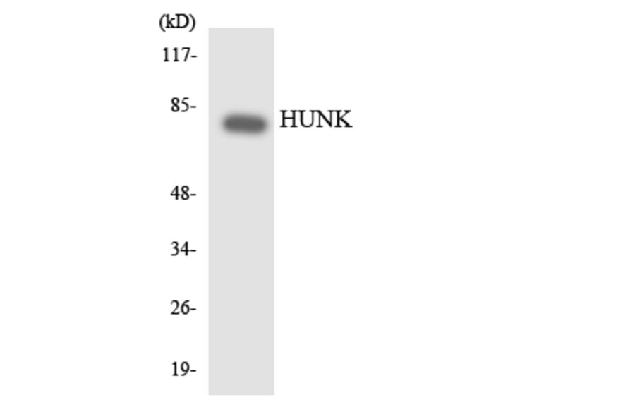 Western Blot - Anti-HUNK Antibody (R12-2906) - Antibodies.com